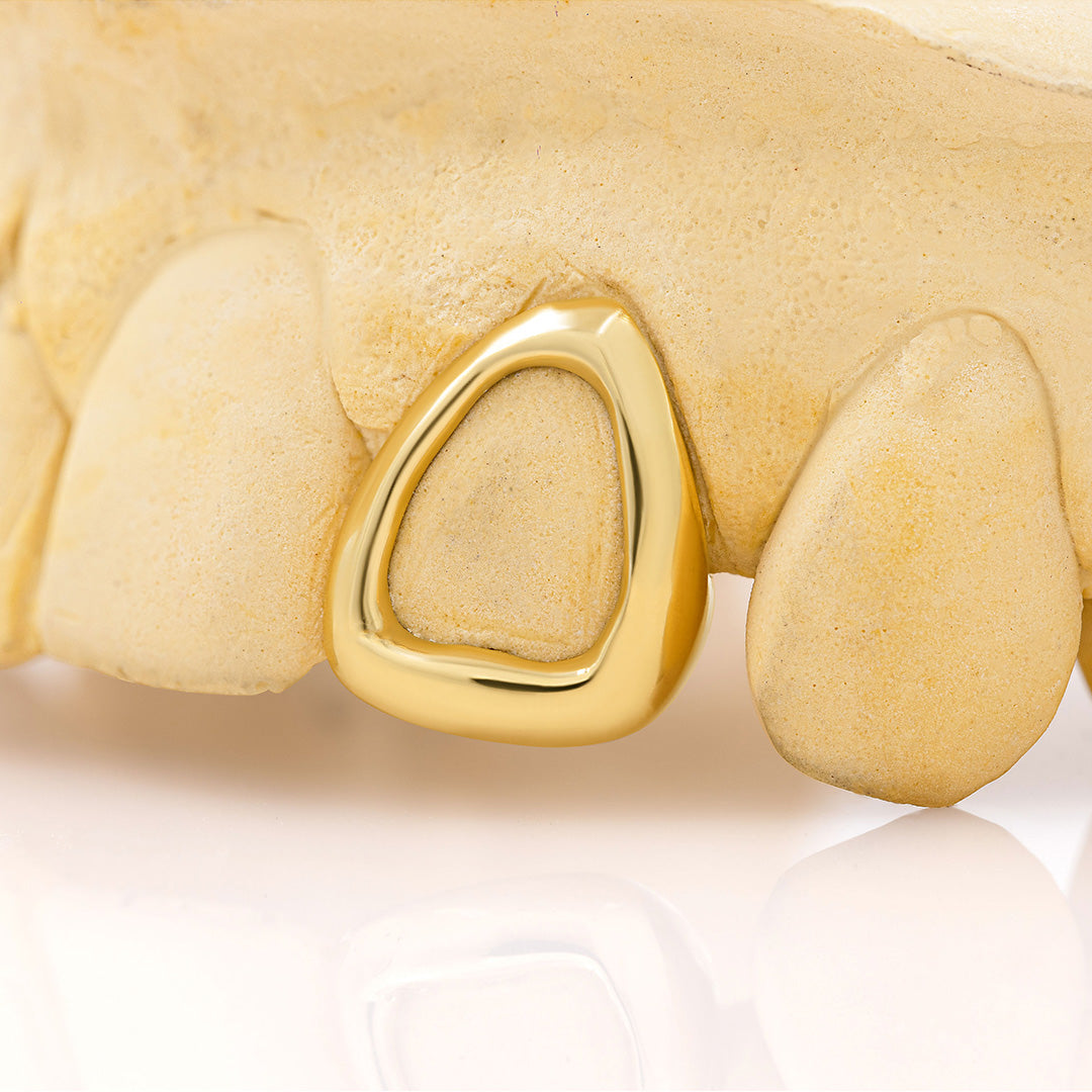 Gold Frame Grillz – product view