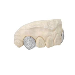 Diamond Grill Cap (Single)